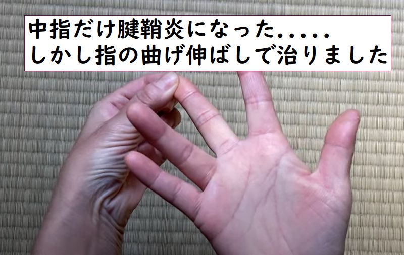 中指だけ腱鞘炎になったが指の曲げ伸ばしストレッチで治りました